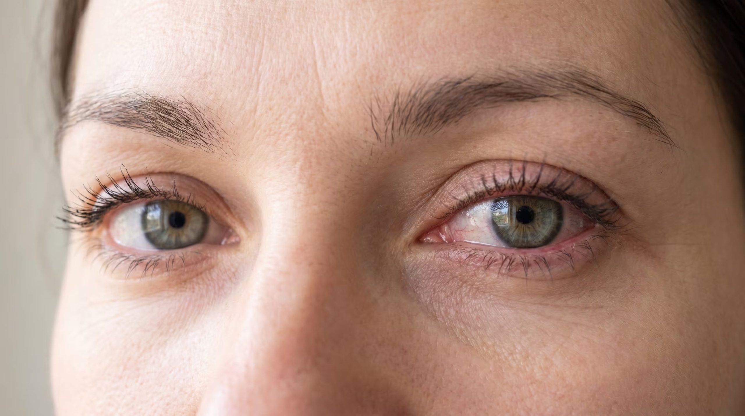 El hábito de frotar los ojos puede facilitar la transmisión de infecciones como la conjuntivitis, advierten organizaciones como Cleveland Clinic y Healthline (Imagen Ilustrativa Infobae)