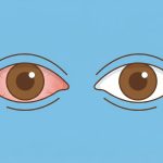 ¿Es peligroso frotarse los ojos? Lo que revelan los expertos