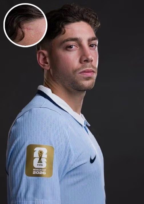 El futbolista Federico Valverde luce una cicatriz en su frente durante la sesión de fotos con la camiseta oficial de la Copa Mundial de la FIFA 2026.