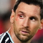 Messi sufrió un corte en el ojo durante el triunfo de Argentina sobre Suiza en el Mundial 2026