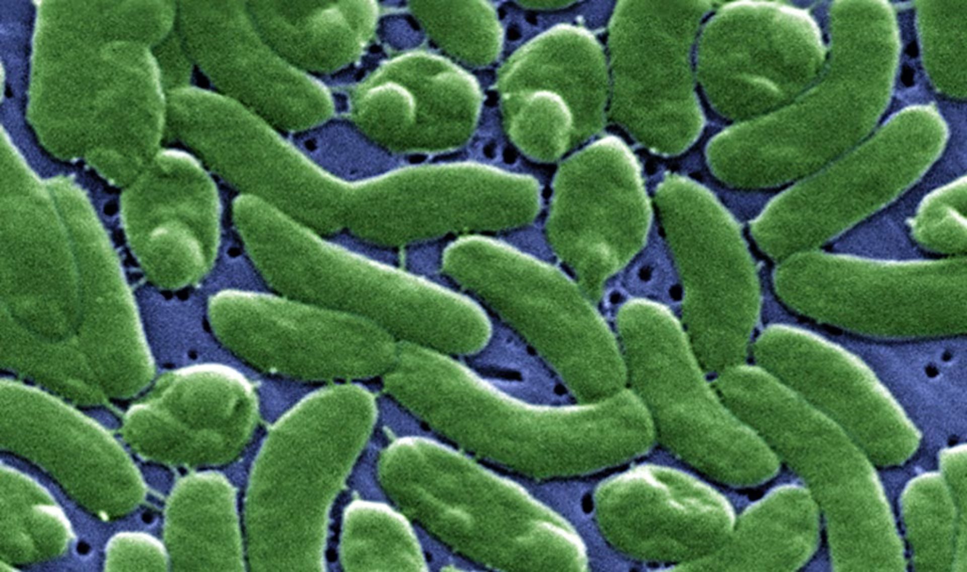 La bacteria “come carne” puede ingresar por heridas en contacto con agua contaminada o por el consumo de mariscos crudos, en particular ostras. (ISCIII/Europa Press)