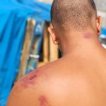 Amnistía Internacional revela torturas militares a migrantes en Ceuta