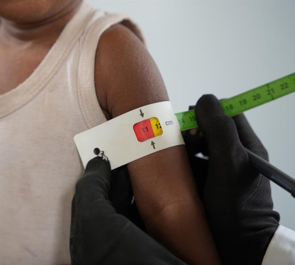 Unicef-advirtio-que-mas-de-25-millones-de-ninos-y